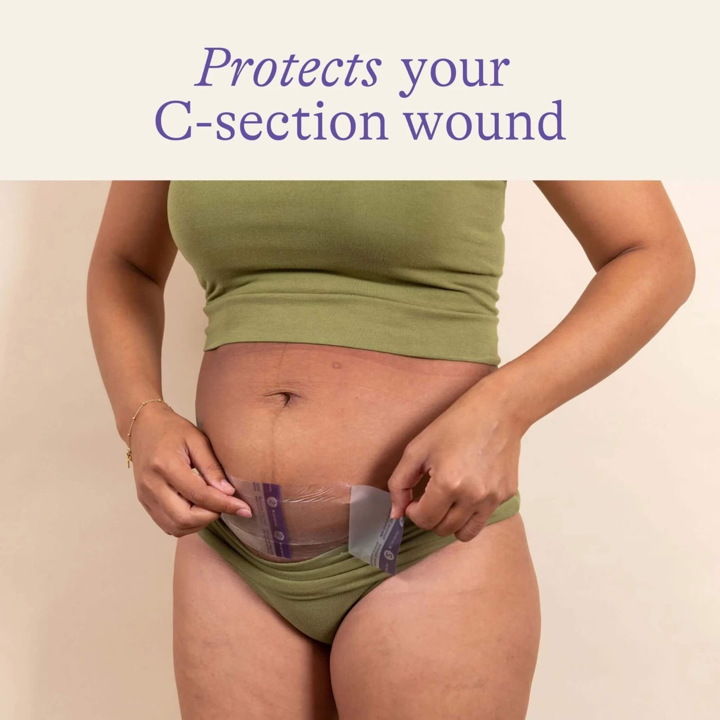 Woman applying a transparent hydrogel dressing over a healed lower abdominal C-section incision while wearing a green co-ord set.