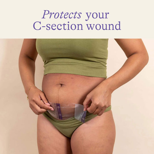 Woman applying a transparent hydrogel dressing over a healed lower abdominal C-section incision while wearing a green co-ord set.